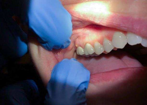 Best Emergency Dental Care for Trauma or Injury in Yoe, PA